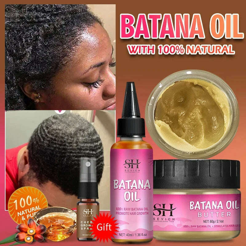 100% Batana Hair Fast Growth Oil Set African Crazy Traction Alopecia Batana Hair Mask chebe oil Hair Regrowth Treatment Sevich - KIMLUD